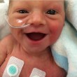 Neonata prematura e lo splendido sorriso: "E' felice di essere viva" FOTO