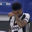 Juventus-Lione, si fa male occhio destro: Dani Alves col volto da pugile2