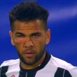 Juventus-Lione, si fa male occhio destro: Dani Alves col volto da pugile3