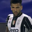 Juventus-Lione, si fa male occhio destro: Dani Alves col volto da pugile