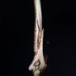 Sci. Lindsey Vonn, addio Coppa del mondo: la campionessa Usa si è rotta un braccio 5