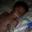 Usa, misteriosa malattia uccide un bimbo di 6 anni: "Attacca il cervello"02