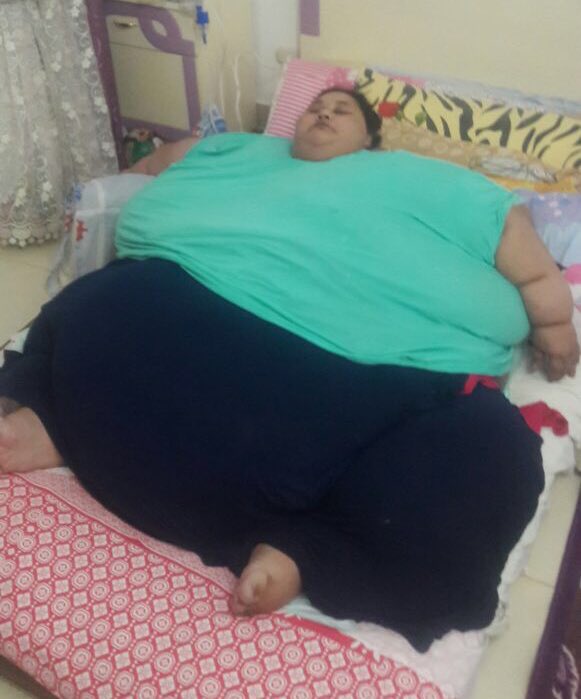 Eman Ahmed, donna egiziana di 500 kg, sarà operata a Mumbai