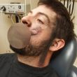 Sigaretta elettronica gli esplode in faccia: perde 7 denti, ustioni sul viso FOTO 3