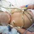 Bimbo ucciso dalla meningite, la mamma pubblica la FOTO: "Ecco cosa fa la malattia"