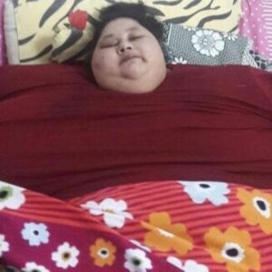 Eman Ahmed, la donna più pesante al mondo, ha perso 50 kg in 12 giorni