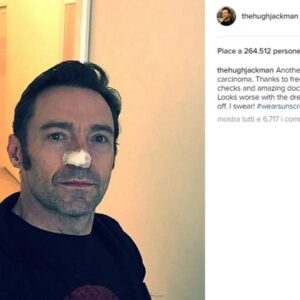 Hugh Jackman operato di nuovo: torna il cancro alla pelle