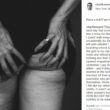 Modella Charli Howard posta FOTO lato B con cellulite: "E' normale averla"