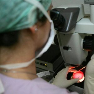 Cancro alla prostata, nuovo test del sangue evita il 40% delle biopsie