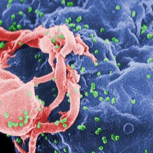 Aids, vaccino per bambini con Hiv: sperimentazione al via in Italia, Thailandia e Sudafrica