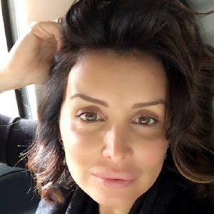 Alessandra Pierelli a Vieni da Me: "Ho rischiato di morire per un intervento di chirurgia estetica"