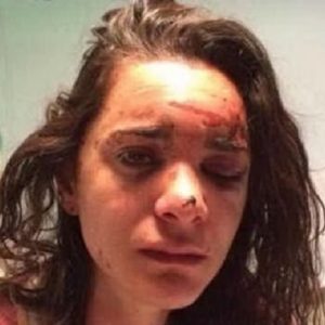 Andrea Sicignano, e la FOTO choc: si è finta morta per salvarsi dal suo aggressore