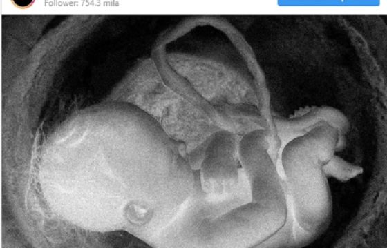 Achille Lauro, su Instagram la FOTO col feto e un messaggio criptico: la genesi2