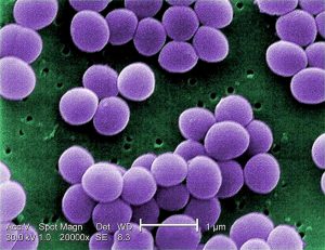 Candida Auris, il fungo diventato killer per il riscaldamento globale: può uccidere in 90 giorni e resiste ai farmaci