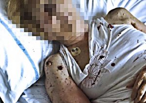 Salerno: salma di una donna piena di formiche nella sala mortuaria dell'ospedale