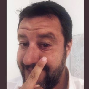 Salvini, l'orzaiolo e la replica di Burioni