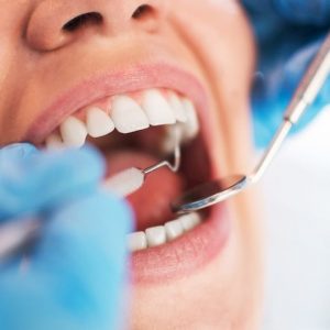 Dentista la opera per una malattia alle gengive: donna muore dissanguata dopo intervento