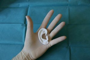 Firenze, 13enne nato senza orecchie: i chirurghi del Meyer le ricostruiscono in 3D
