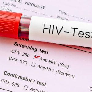 Aids, in calo i nuovi casi di HIV: nel 2018 sono stati il 20% in meno