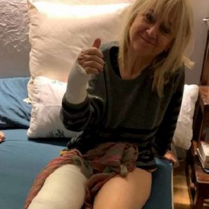 Luciana Littizzetto, foto col gesso postata su Instagram: rotula e polso rotti