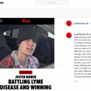 Justin Bieber ha la malattia di Lyme: "Non ero drogato, ho passato mesi difficili"