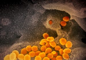 Coronavirus, l'influenza stagionale ne uccide di più? Il confronto