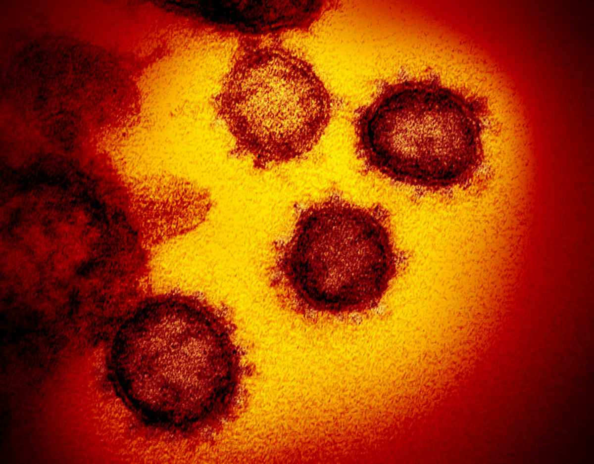 Coronavirus, in Islanda scoperte 40 mutazioni. "Diventerà più infettivo ma meno pericoloso"