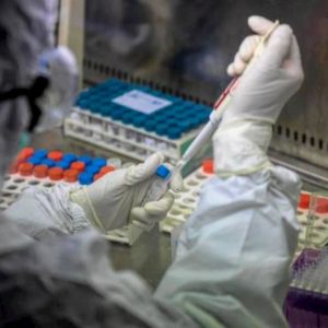 Coronavirus, entro aprile il nuovo test rapido per gli anticorpi