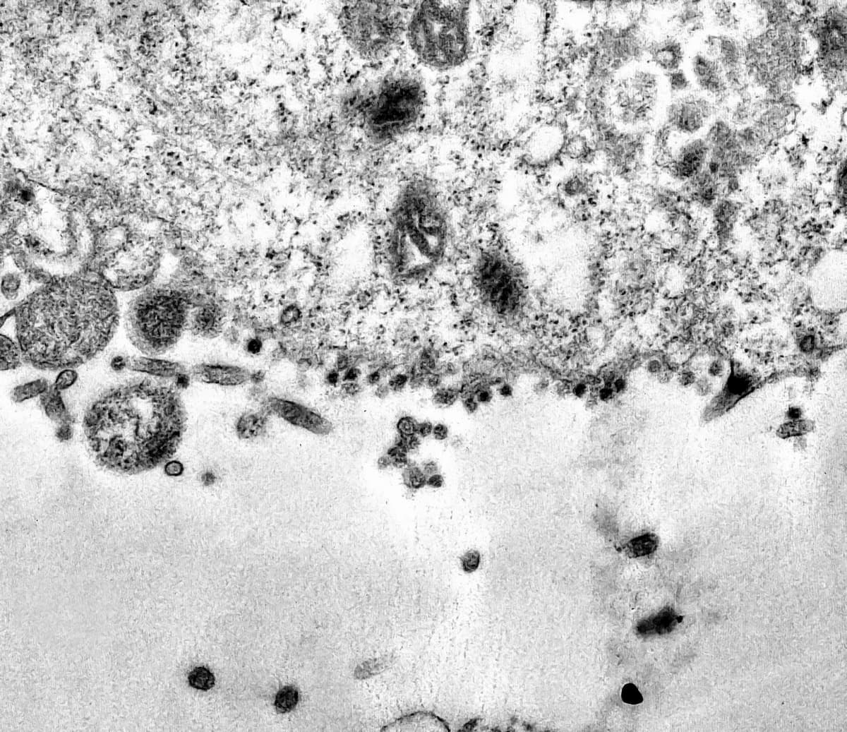 Coronavirus, fotografato il momento in cui il Covid-19 attacca le cellule