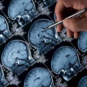 Il pensiero negativo persistente aumenta il rischio di malattie collegate alla demenza