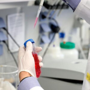 Vaccino italiano contro il coronavirus, allo Spallanzani al via i test sull'uomo