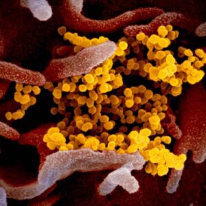 Covid: origini, anticorpi, contagiosità... I punti oscuri del coronavirus
