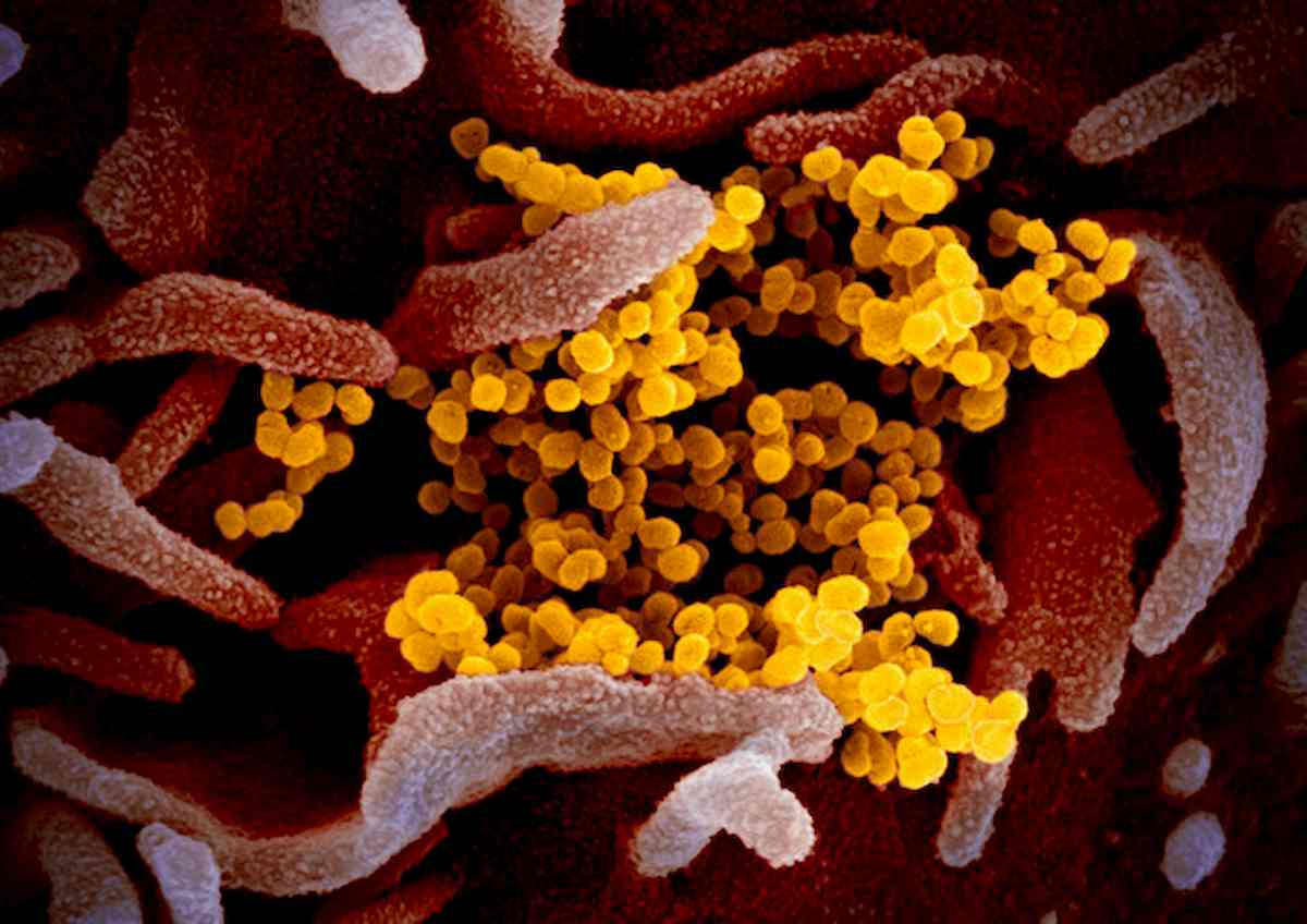 Covid: origini, anticorpi, contagiosità... I punti oscuri del coronavirus