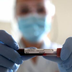 Il vaccino Pfizer anti Covid deve stare a -70 gradi: dopo una settimana va a male