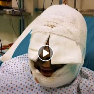 Gessica Notaro mostra per la prima volta il volto deturpato dall'acido gettato dal suo ex VIDEO