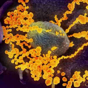 Coronavirus nuova variante California
