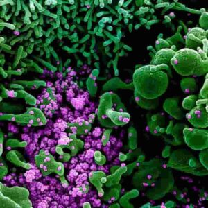 Coronavirus, contagi tornano a salire: ma non i numeri di morti e terapie intensive