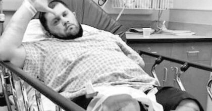 Jimmy Rave, il dramma dell'ex wrestler: gambe amputata a causa di una infezione
