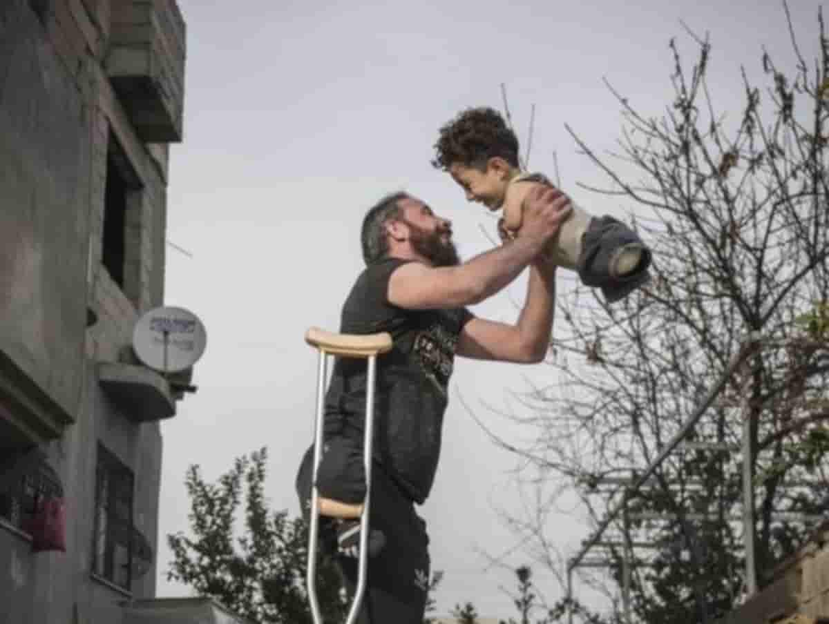 Mehmet Aslan, la foto simbolo della guerra in Siria: bambino senza gambe né braccia e il padre mutilato