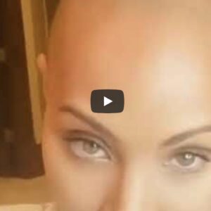 Jada Pinkett Smith si mostra senza capelli su Instagram: "Io e la mia alopecia diventeremo amiche"