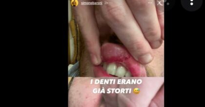 Simone Baroni, l'ex ballerino di Amici è stato picchiato perché gay: lui ha ripreso i suoi aggressori e li ha denunciati