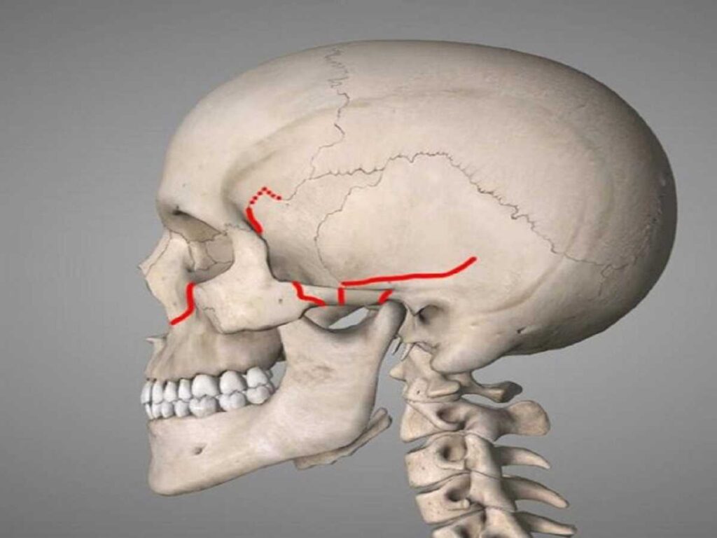 Le fratture del cranio visti nella parte laterale