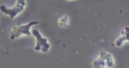 L'ameba mangia-cervello vista al microscopio