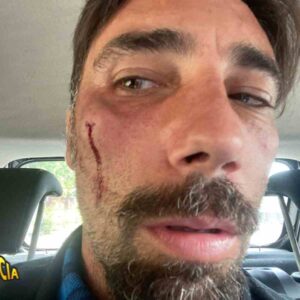 Vittorio Brumotti di Striscia picchiato e rapinato in vacanza a Los Angeles: "Mi hanno messo la pistola in bocca"