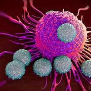 Cancro al pancreas, ecco 5 segnali scioccanti di uno dei tumori più mortali al mondo, è il quinto più mortale