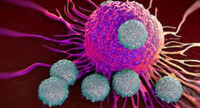 Cancro al pancreas, ecco 5 segnali scioccanti di uno dei tumori più mortali al mondo, è il quinto più mortale