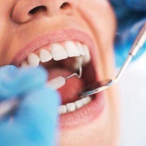 Al dentista sfugge l'ago del trapano e finisce in gola alla paziente