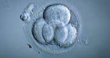 gemelli embrioni congelati