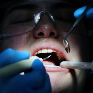 tumore dentista