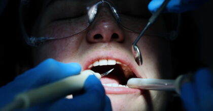 tumore dentista